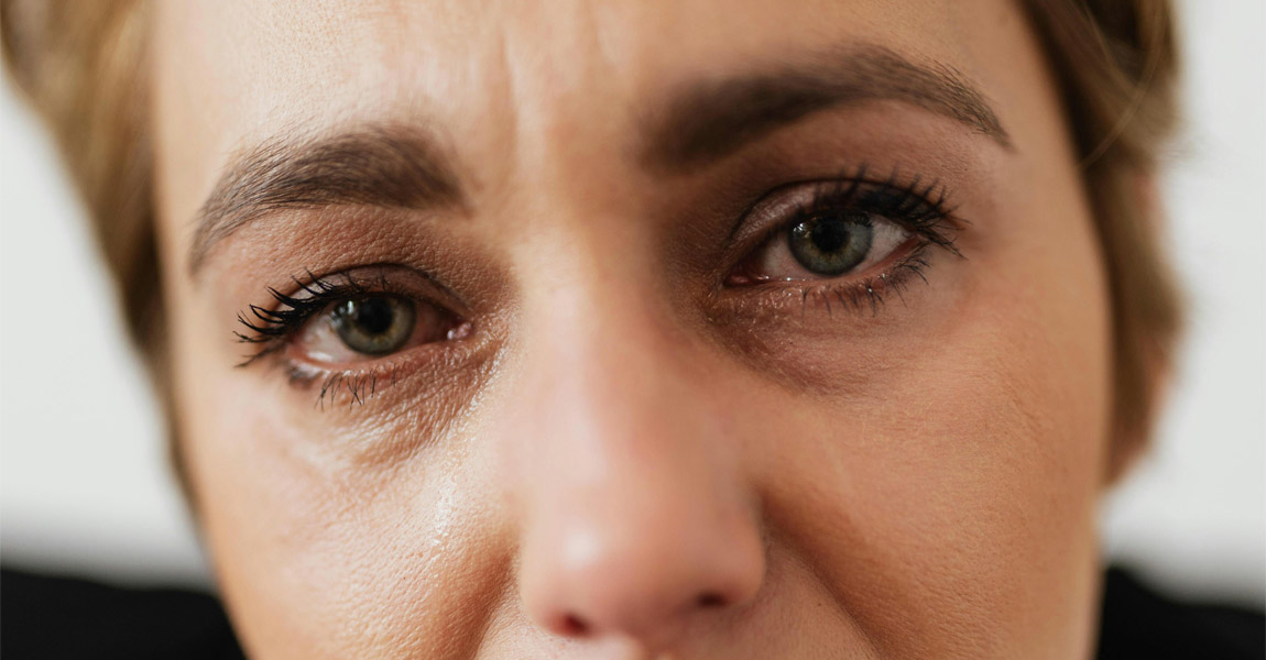 Close up of woman's face with sad and tearful eyes.